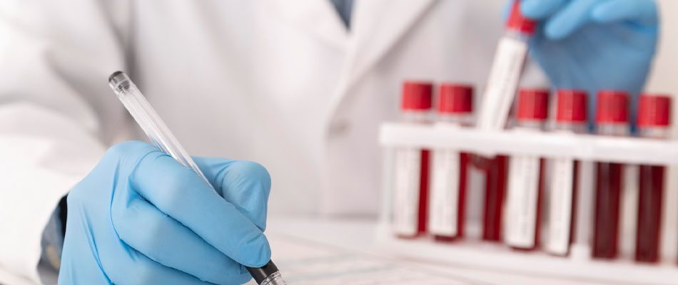 A person wearing blue gloves writes on a form with a pen, while another hand holds a test tube of blood. Several blood samples in red-capped tubes are in a rack on a white table. | California Urgent Care Center